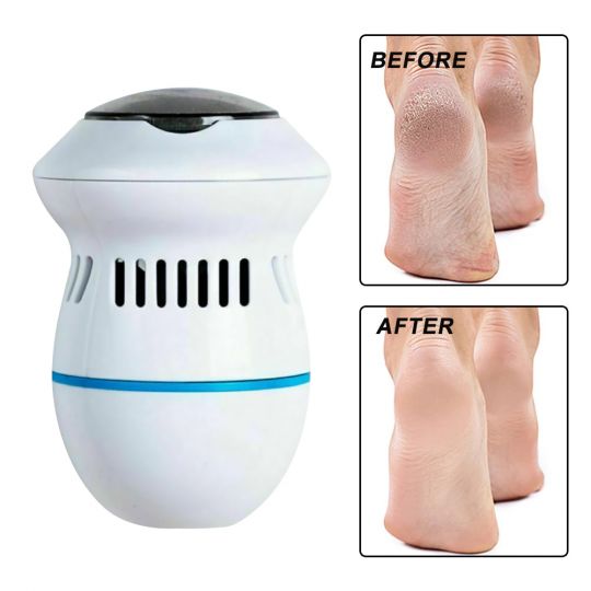 Round Electric Foot File Grinder Pedi Vac