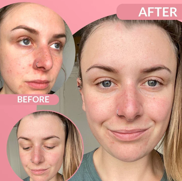 Pore Cleanser & Blackhead Remover