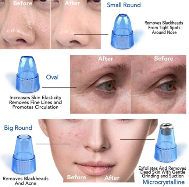 Pore Cleanser & Blackhead Remover