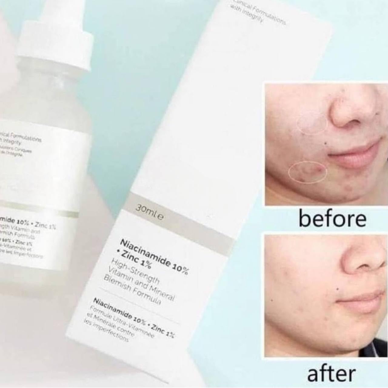 The Ordinary Niacinamide 10% + Zinc 1% Serum