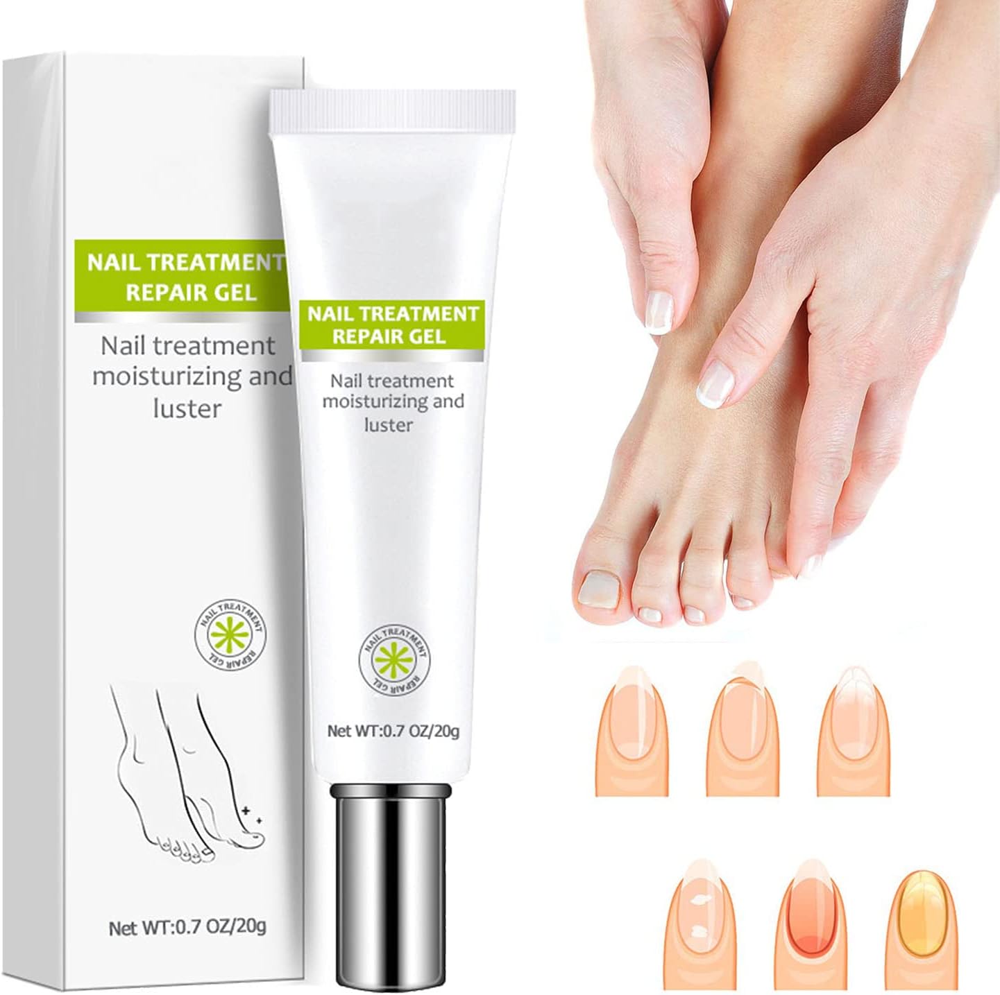 Nail Repair - Nail Treatment Repair Gel (Renews Yellow, Cracked, Damaged Nails)