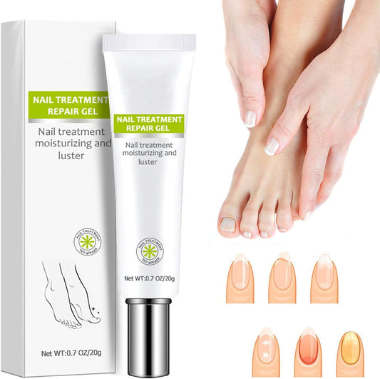 Nail Repair - Nail Treatment Repair Gel (Renews Yellow, Cracked, Damaged Nails)