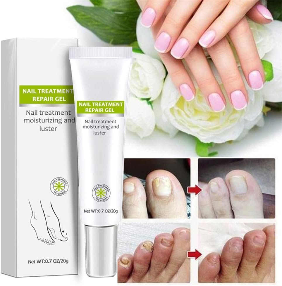 Nail Repair - Nail Treatment Repair Gel (Renews Yellow, Cracked, Damaged Nails)