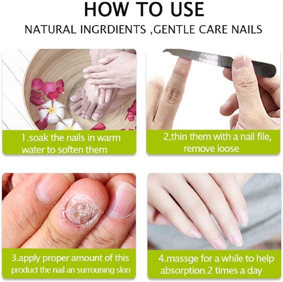 Nail Repair - Nail Treatment Repair Gel (Renews Yellow, Cracked, Damaged Nails)