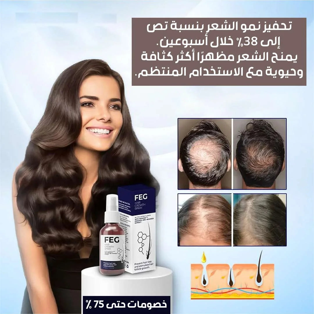 بخاخ نمو الشعر FEG