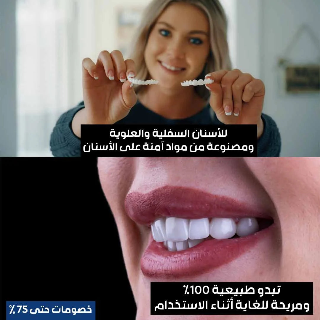 أسنان ابتسامة هوليوود