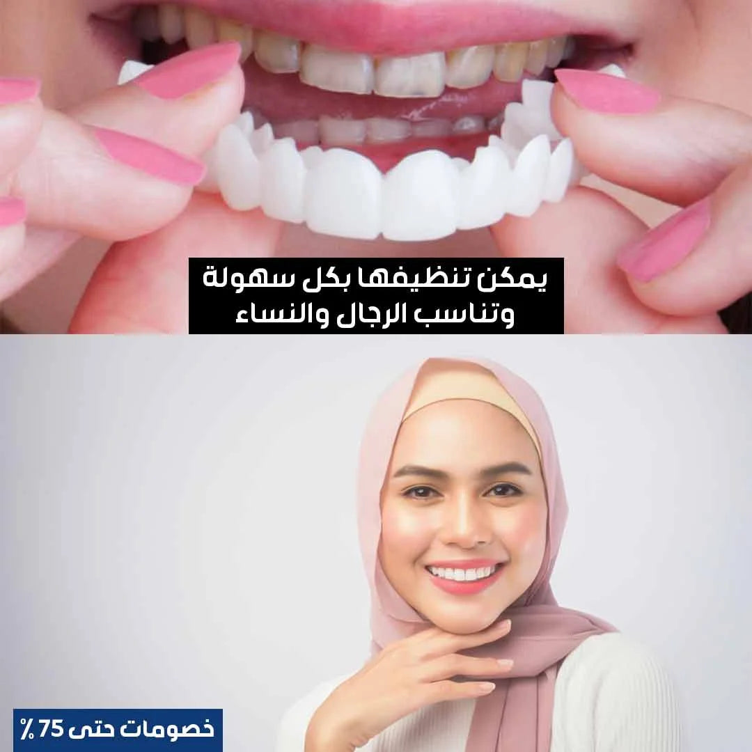 أسنان ابتسامة هوليوود