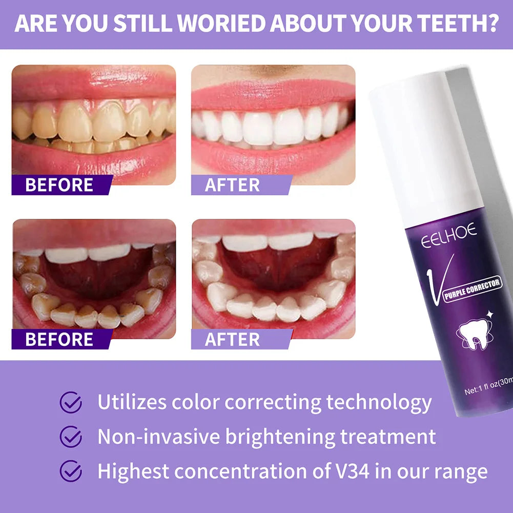 Teeth Whitening, Stains Removal, Tooth Cleaning Brightening Toothpaste