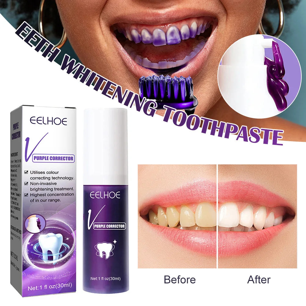 Teeth Whitening, Stains Removal, Tooth Cleaning Brightening Toothpaste